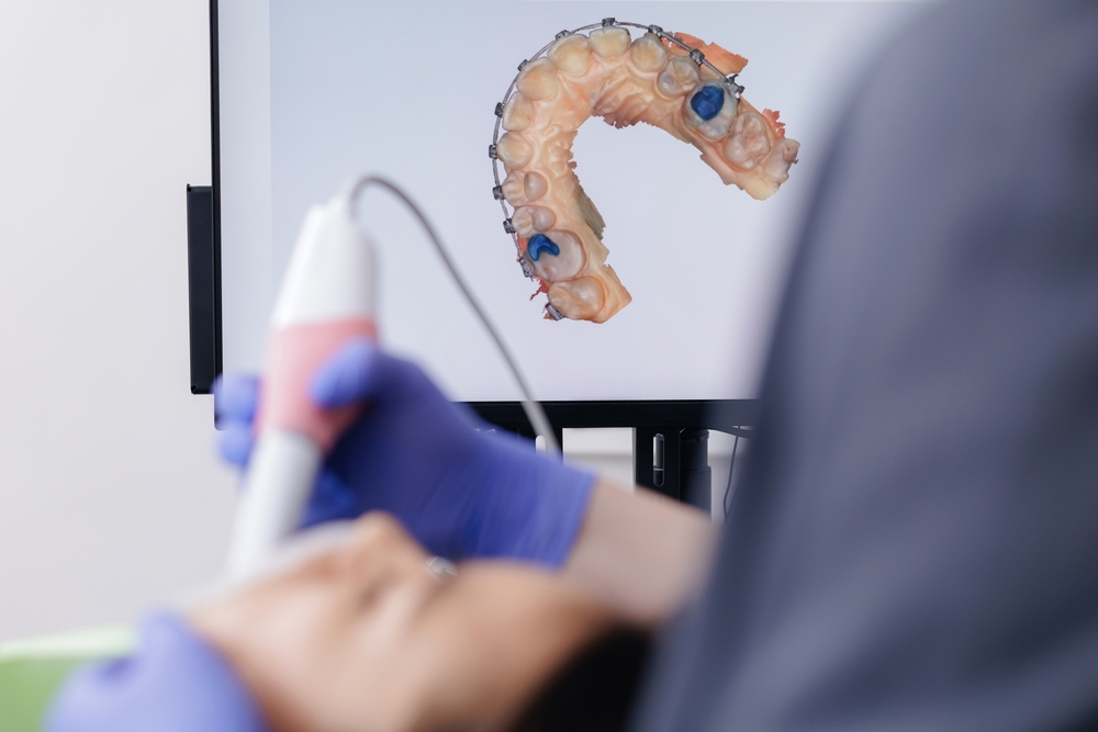 High-quality dental results with Digital Impressions